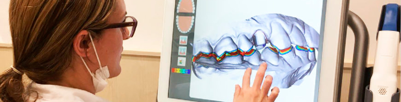 Estudio de tecnologías para escaneo 3D y escáneres en ortodoncia.